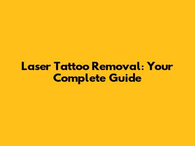 Laser Tattoo Removal: Your Complete Guide