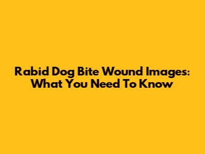 Rabid Dog Bite Wound Images: What You Need To Know