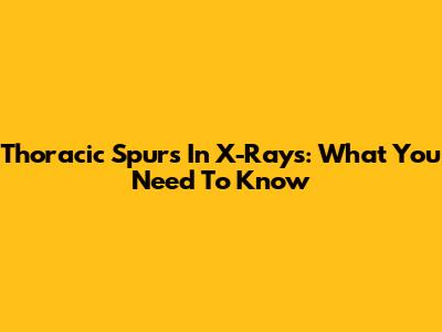 Thoracic Spurs In X-Rays: What You Need To Know